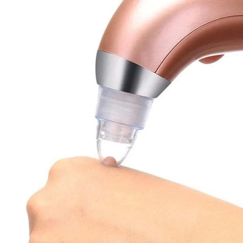 Acne Pore Vacuum Cleaner Blackhead Remover