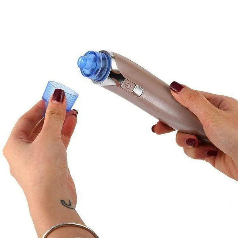 Acne Pore Vacuum Cleaner Blackhead Remover