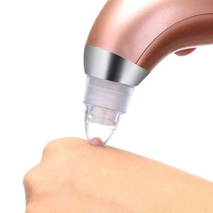 Acne Pore Vacuum Cleaner Blackhead Remover